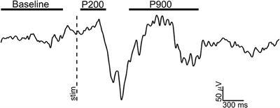 Local Gamma Activity During Non-REM Sleep in the Context of Sensory Evoked K-Complexes